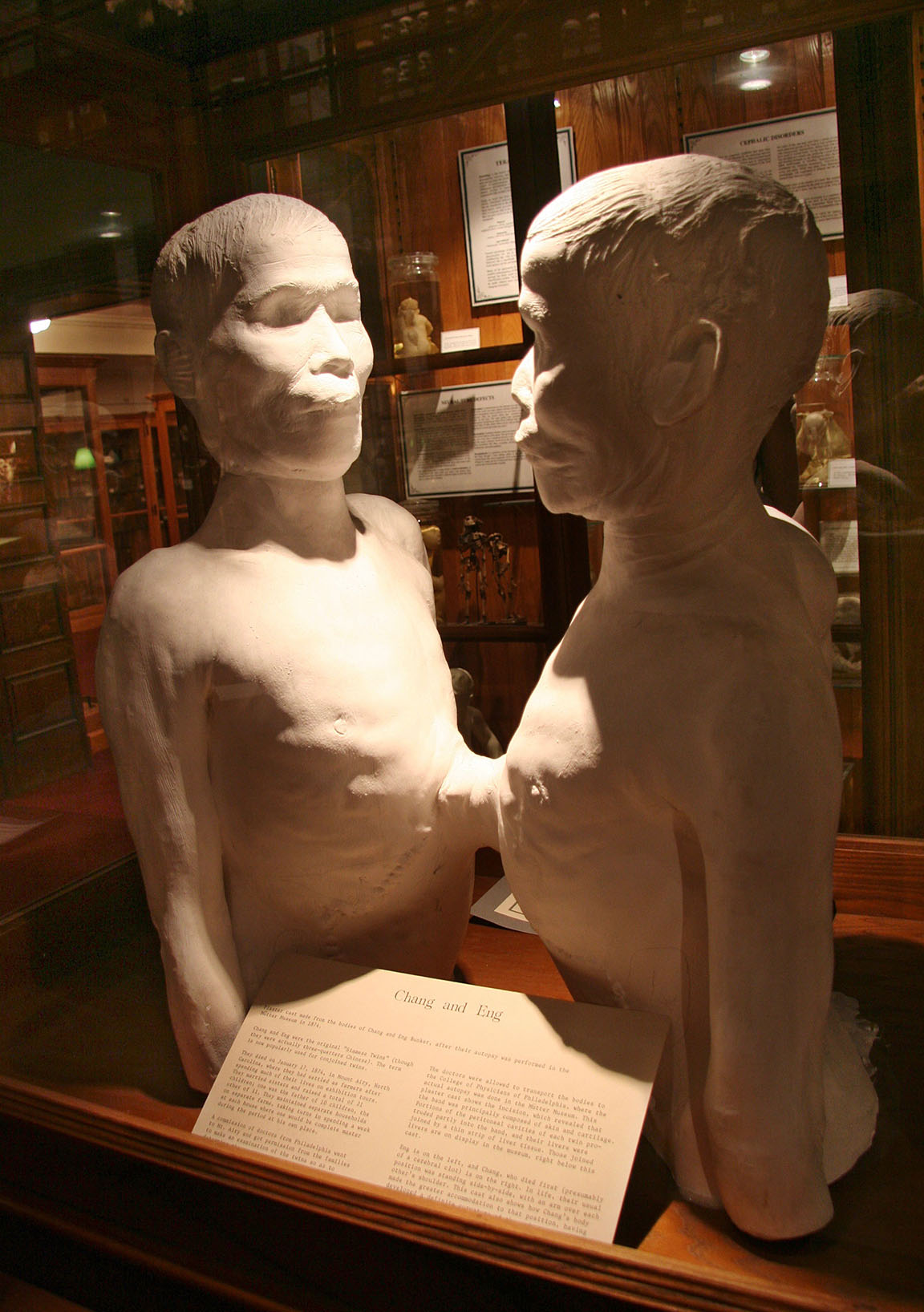 Chang & Eng, Mutter Museum, Philadelphia